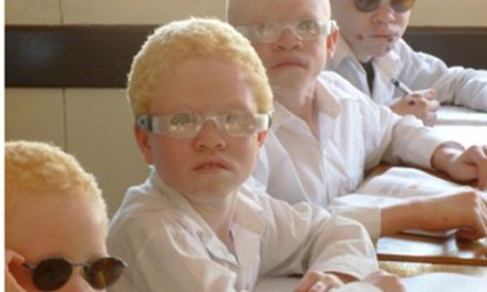 Government pledges support and protection of people with albinism