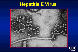 Suspected cases of Hepatitis E rise to 3009 – ministry discourages shaking of hands