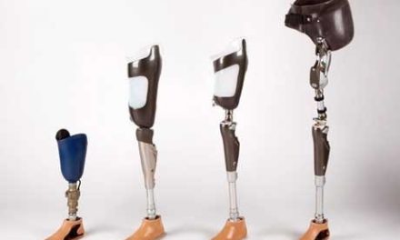 Hundreds of people set to benefit from prosthetic limb camp