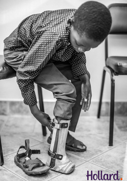Boy who lost leg in freak accident gets new prosthetic replacement