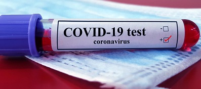 Private laboratories investigated over alleged excessive pricing of COVID-19 tests