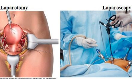 Minimally invasive surgery in modern gynaecology