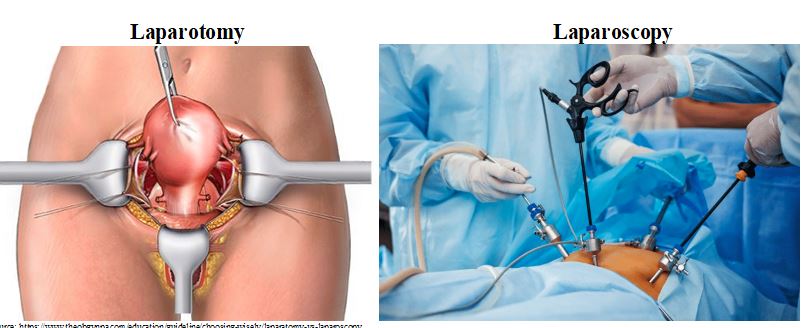 Minimally invasive surgery in modern gynaecology